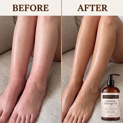 LymphLift Ginger Lymphatic Drainage Oil (8 fl oz)